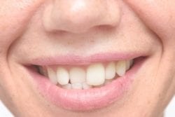 cosmetic dentistry in strongsville, ohio