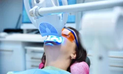 Professional Teeth Whitening vs. Over-the-Counter in Strongsville, OH