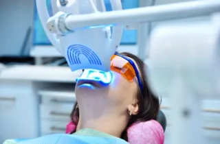 Professional Teeth Whitening vs. Over-the-Counter in Strongsville, OH
